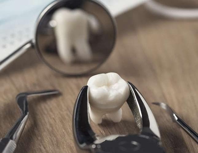 Extracting Certain Teeth Can Boost Orthodontic Effectiveness