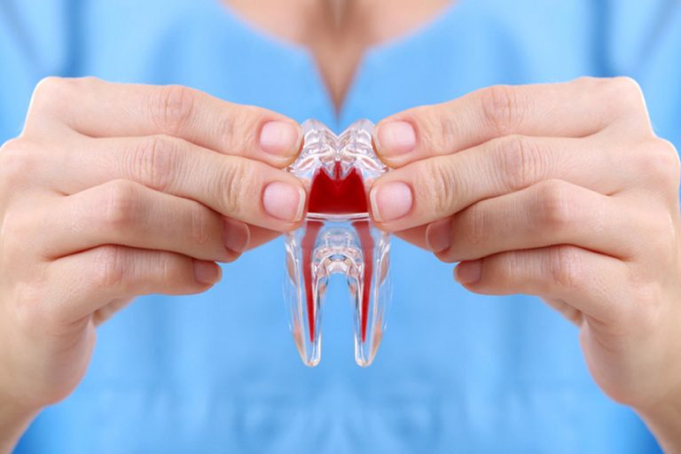 endodontics